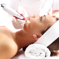 Microneedling